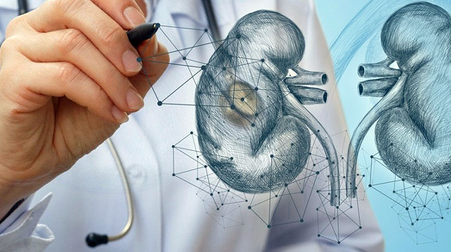 РАК ПОЧКИ. ГЕНДЕРНОЕ НЕРАВЕНСТВО