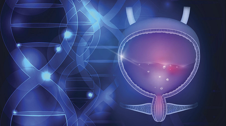 Новый режим проведения внутрипузырной химиотерапии при раке мочевого пузыря