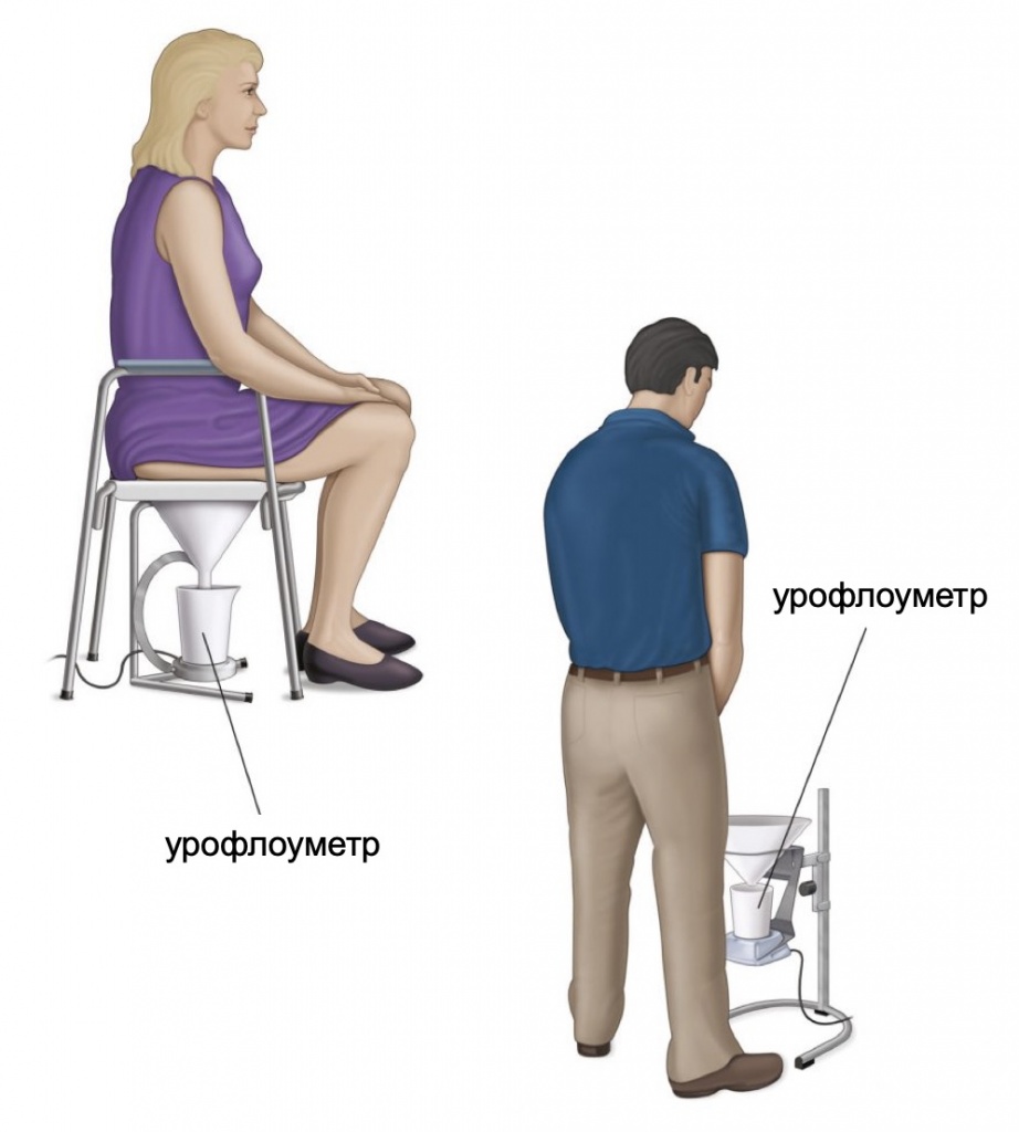 urofloumetriya.jpg
